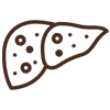 Liver Cirrhosis