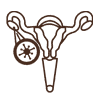 Ovarian Cysts