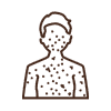 Systemic Lupus Erythematosus